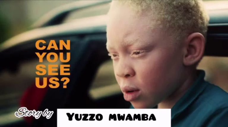 Yuzzo Mwamba – Story Ya Albino